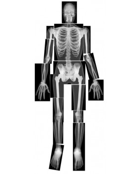Rontgenové snímky ľudskej kostry